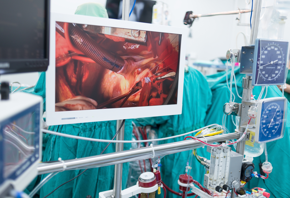 臨床工学士がチェックしている人工心肺の画像